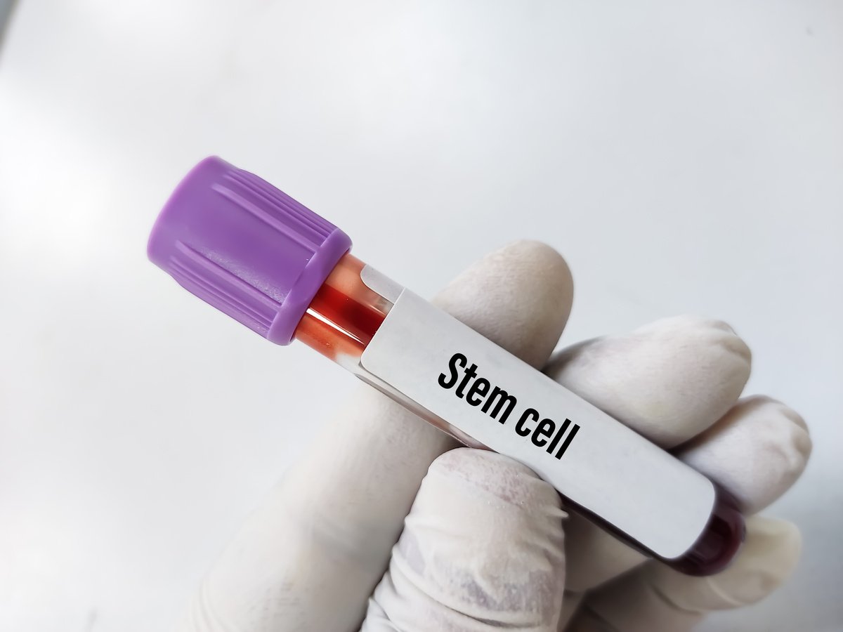 Blood sample tube for stem cells test, neurological or heart disease, embryonic stem cells